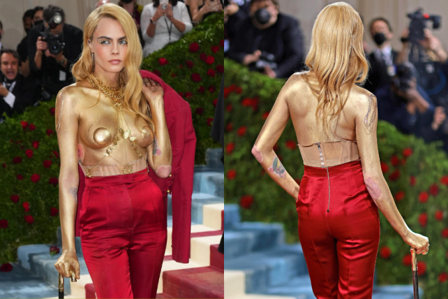 Cara Delevingne 皮膚敏感